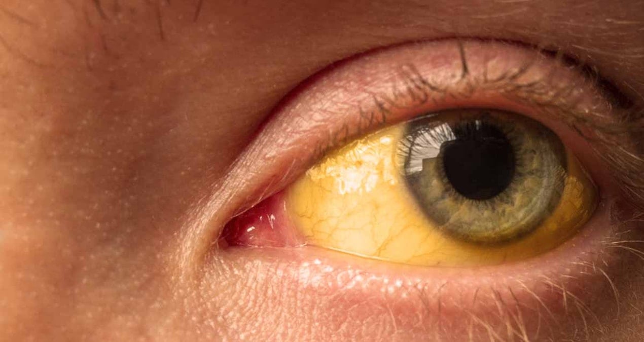 4 Avrupa tatil beldesine acil seyahat uyarısı: Binlerce kişi hastalandı, 9 kişi öldü