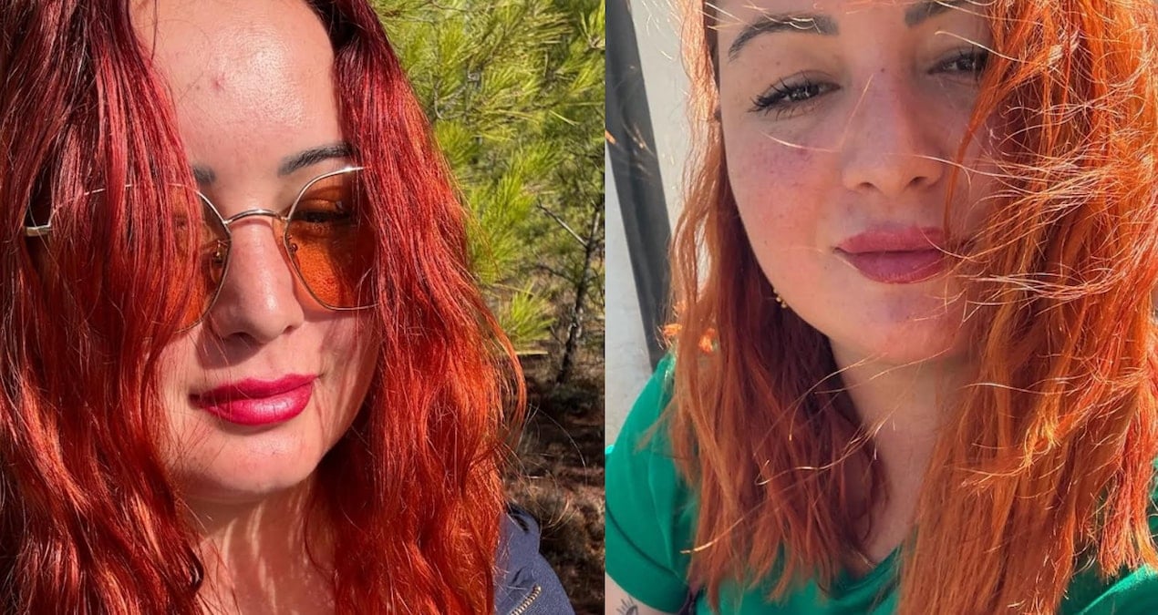 Motosikletiyle kaza yapan Merve Sönmez’den acı haber geldi